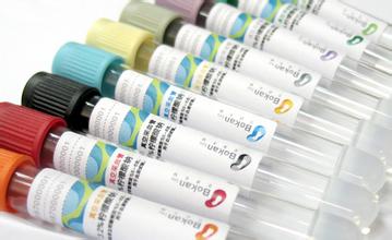 10月18日，esball将参与韩国KSNS会议