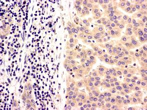 esball(中国区)官方网站