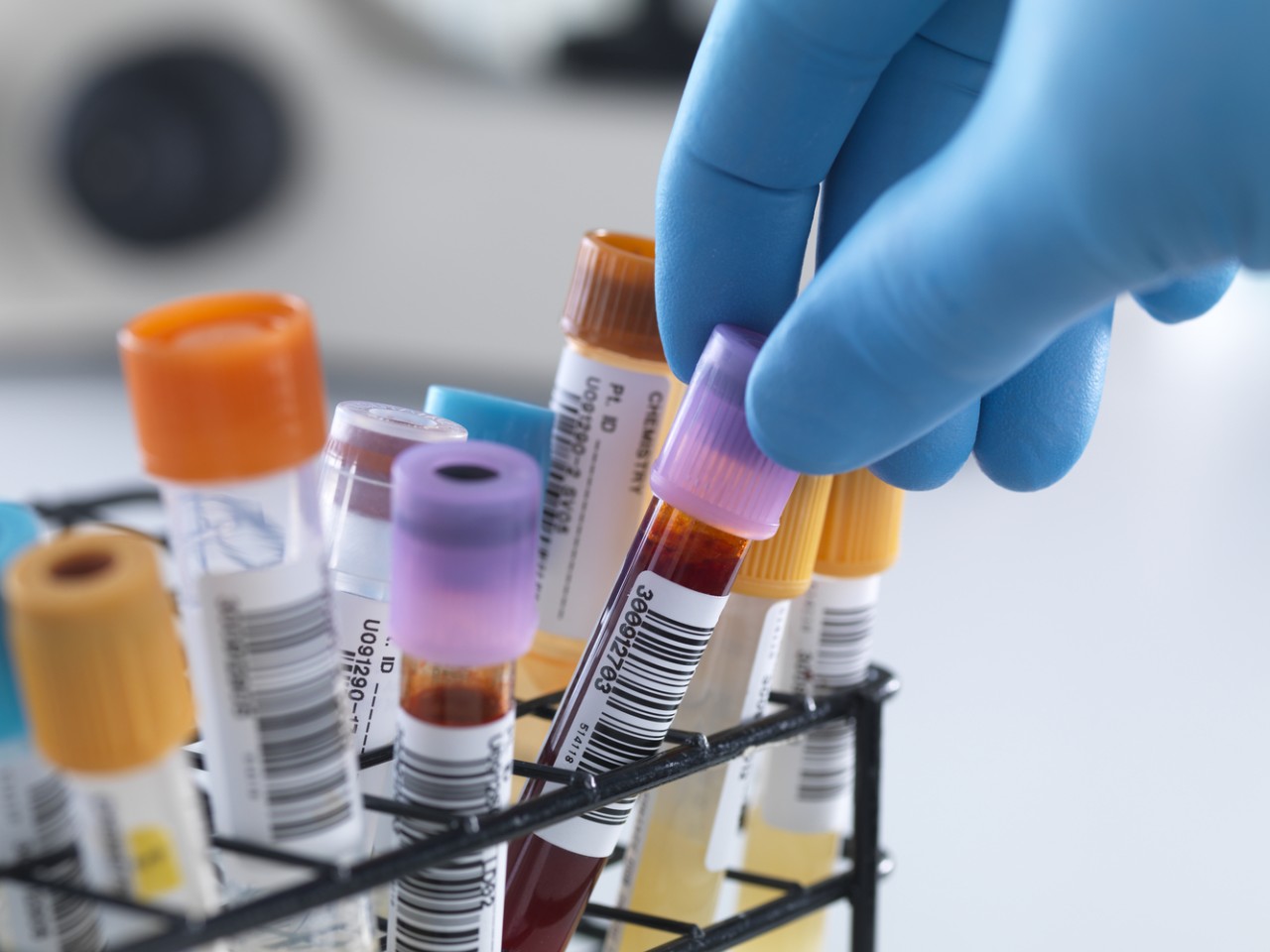 “溶出”还是“BE”，何为临床疗效“金尺度”