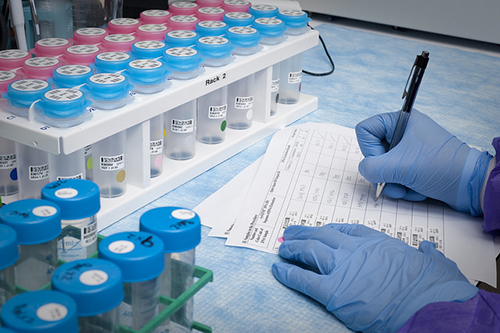 靶向Kindlin-1预防乳腺癌肺转移