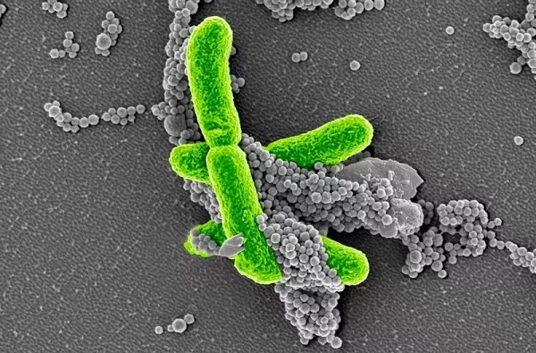 30年后科学家找到败血症钻研新模型
