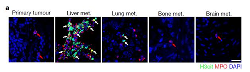 转入幼鼠模型得到一样的试验了局，且在转移产生前NET已在肝脏聚积。