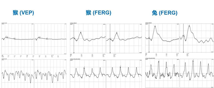 眼电生理项目部门尝试了局展示