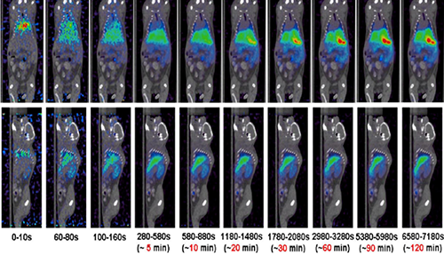 esballPET/CT分子影像技术平台
