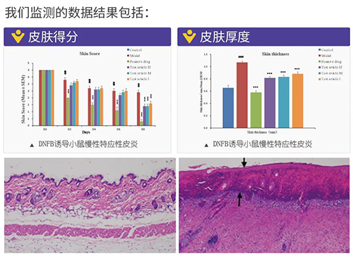 esball成立的特应性皮炎及湿疹模型监测数据了局