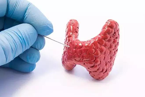 甲状腺疾病，蕴含甲状腺职能减退和甲状腺职能亢进，自古以来就是反复被医学钻研人员钻研的疾病