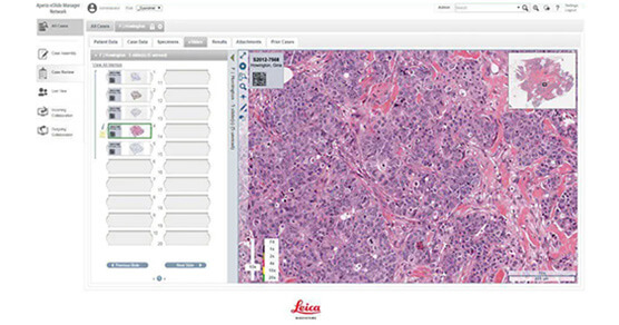 Leica--eSlide分析治理软件