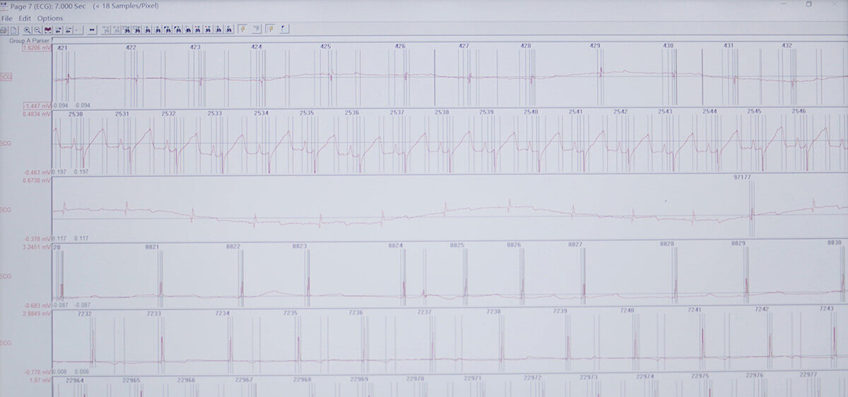 esball SEND 数据转换平台