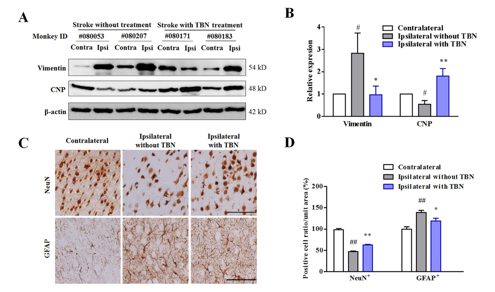 TBN是一种医治缺血性卒中的新型临床候选药物，本钻研中TBN通过esball合成